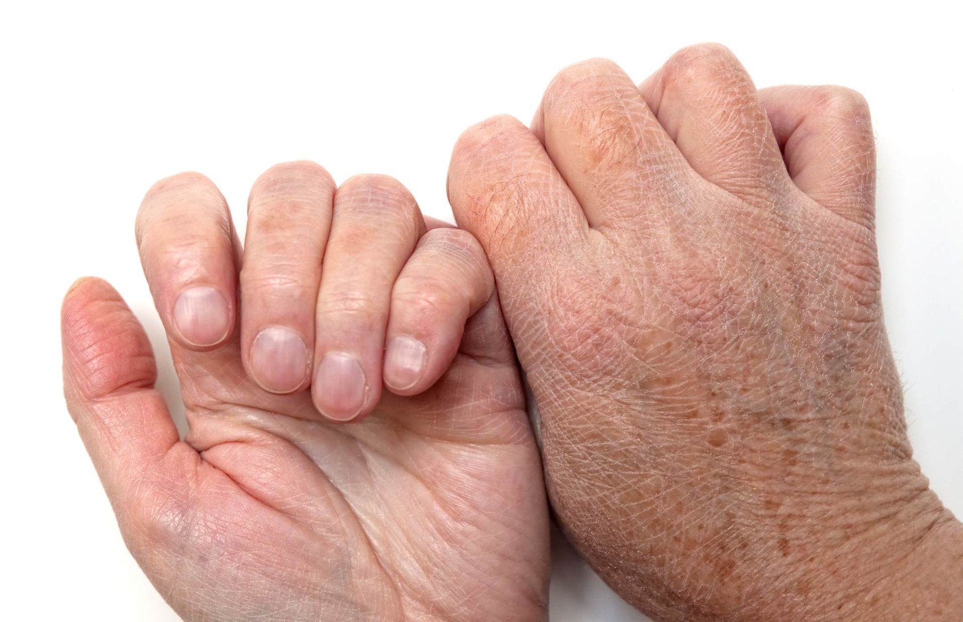 Senior's Hands Showing Nails | Ballarat, VIC | Building Health Naturopathy