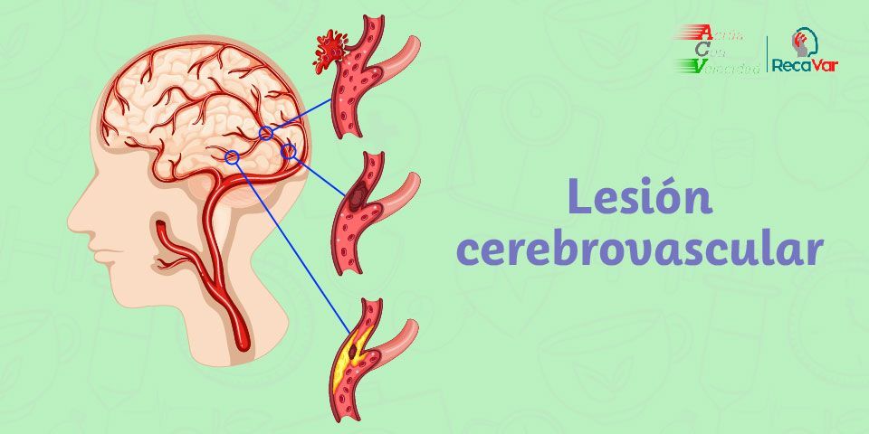 Lesión cerebrovascular Lesión cerebrovascular