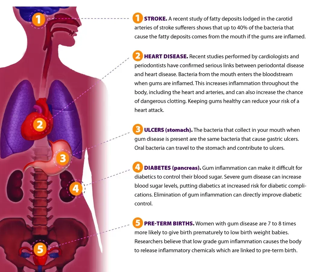 A diagram of the human body showing the causes of various diseases A diagram of the human body showing the causes of various diseases