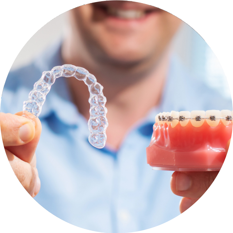 A man is holding a clear retainer and a model of teeth.