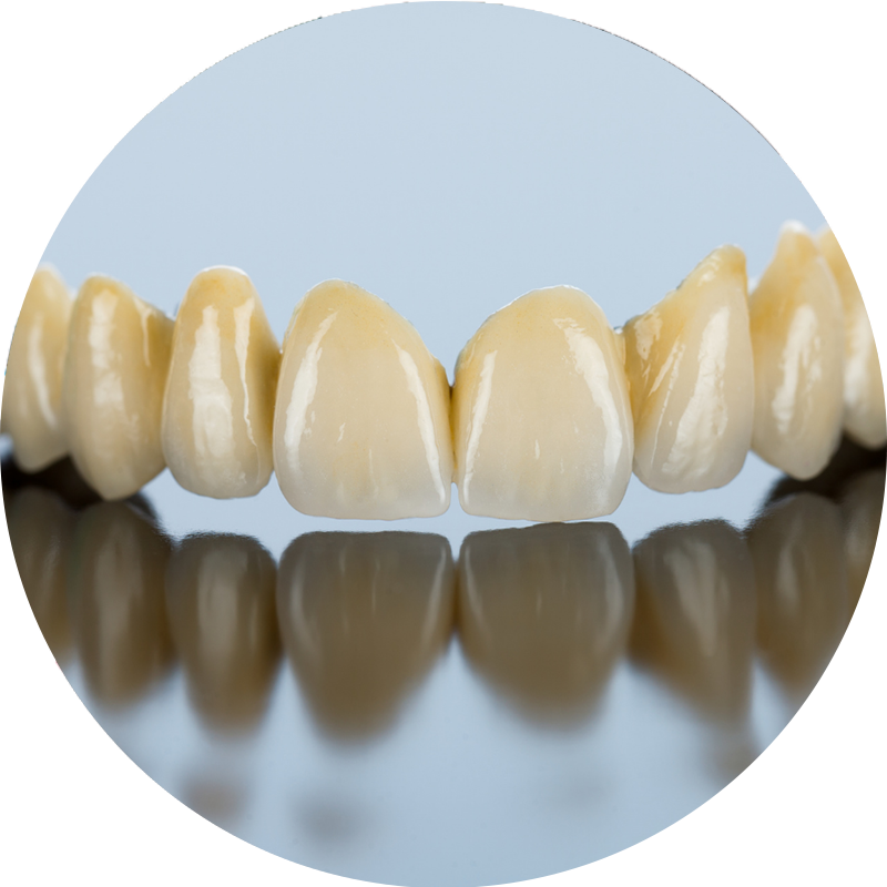 A close up of a row of teeth.