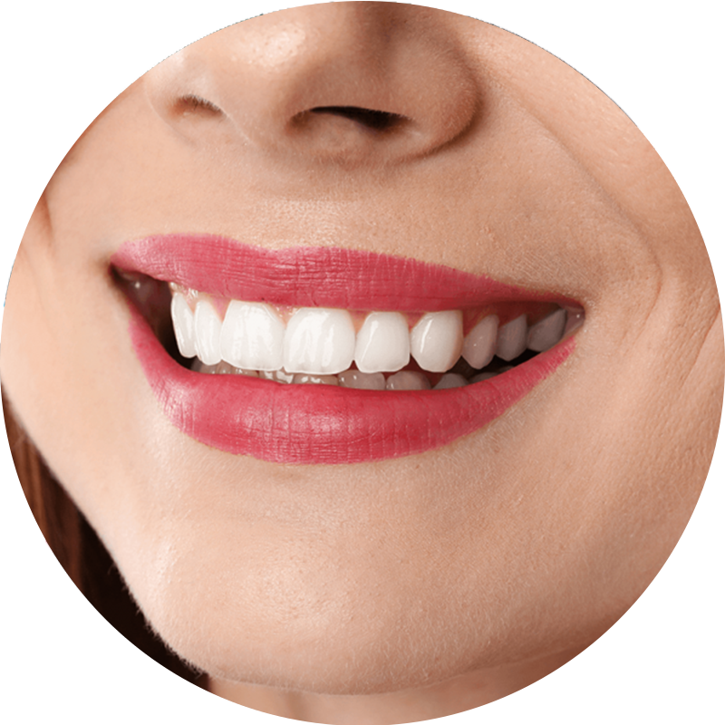 A close up of a woman's smile with white teeth and red lipstick.