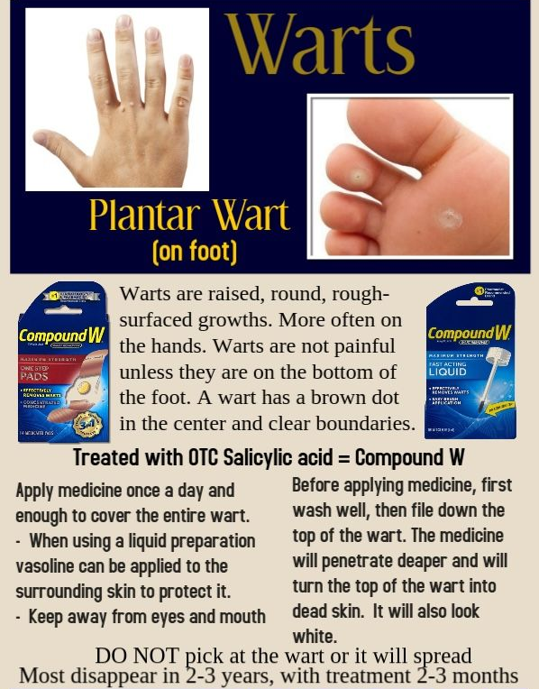Warts treatment poster showing plantar wart photos and Compound W product details