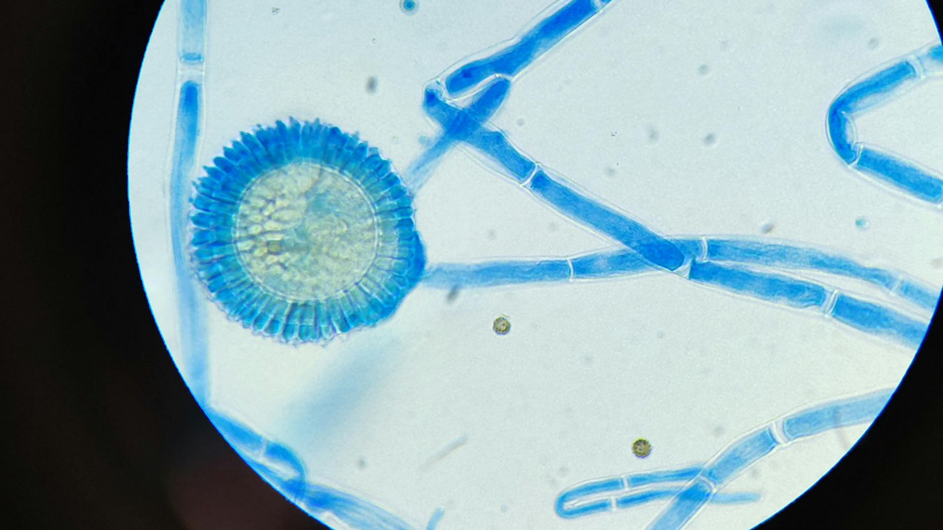 Microscopic view of blue fungal filaments and a circular spore structure on a white background