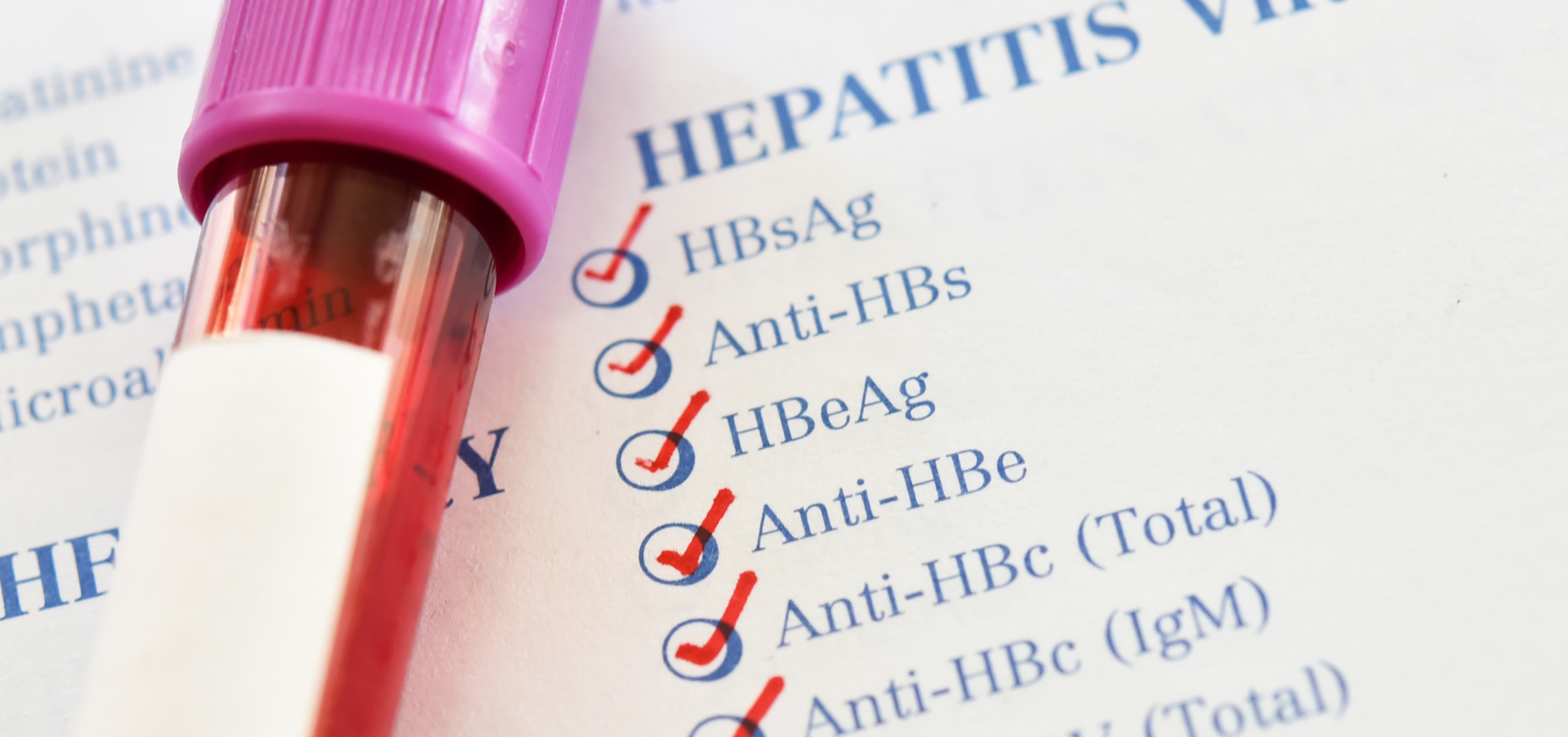 A blood draw test tube next to a checklist of antigens for Hepatitis testing.