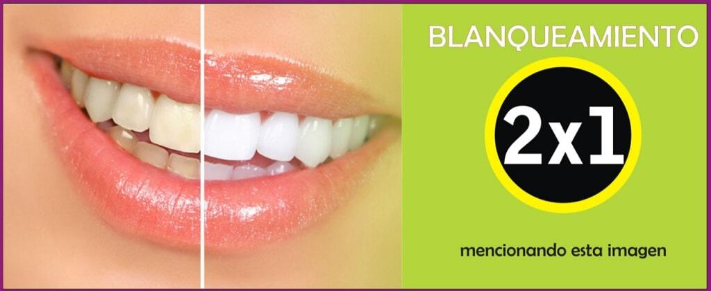Blanqueamiento
