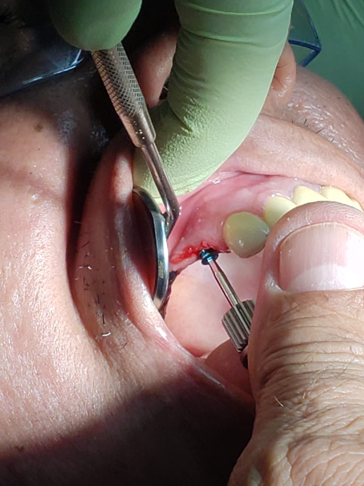 WENDLER DENTAL