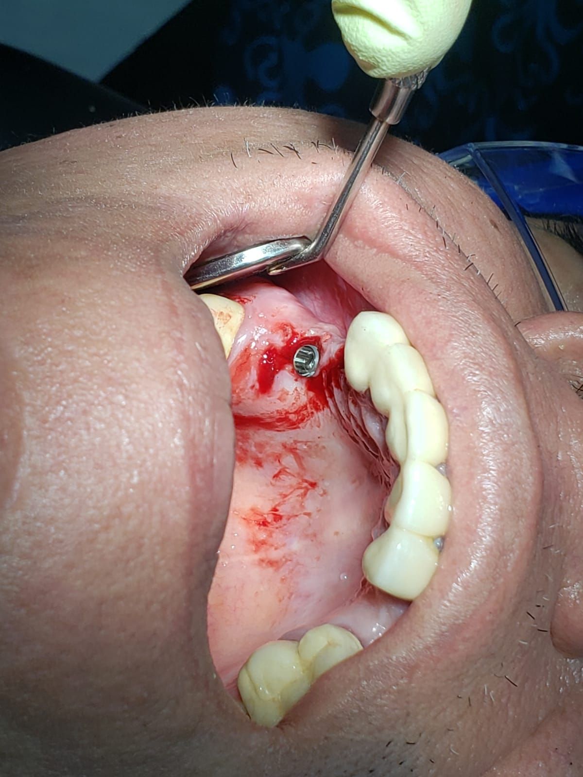 WENDLER DENTAL