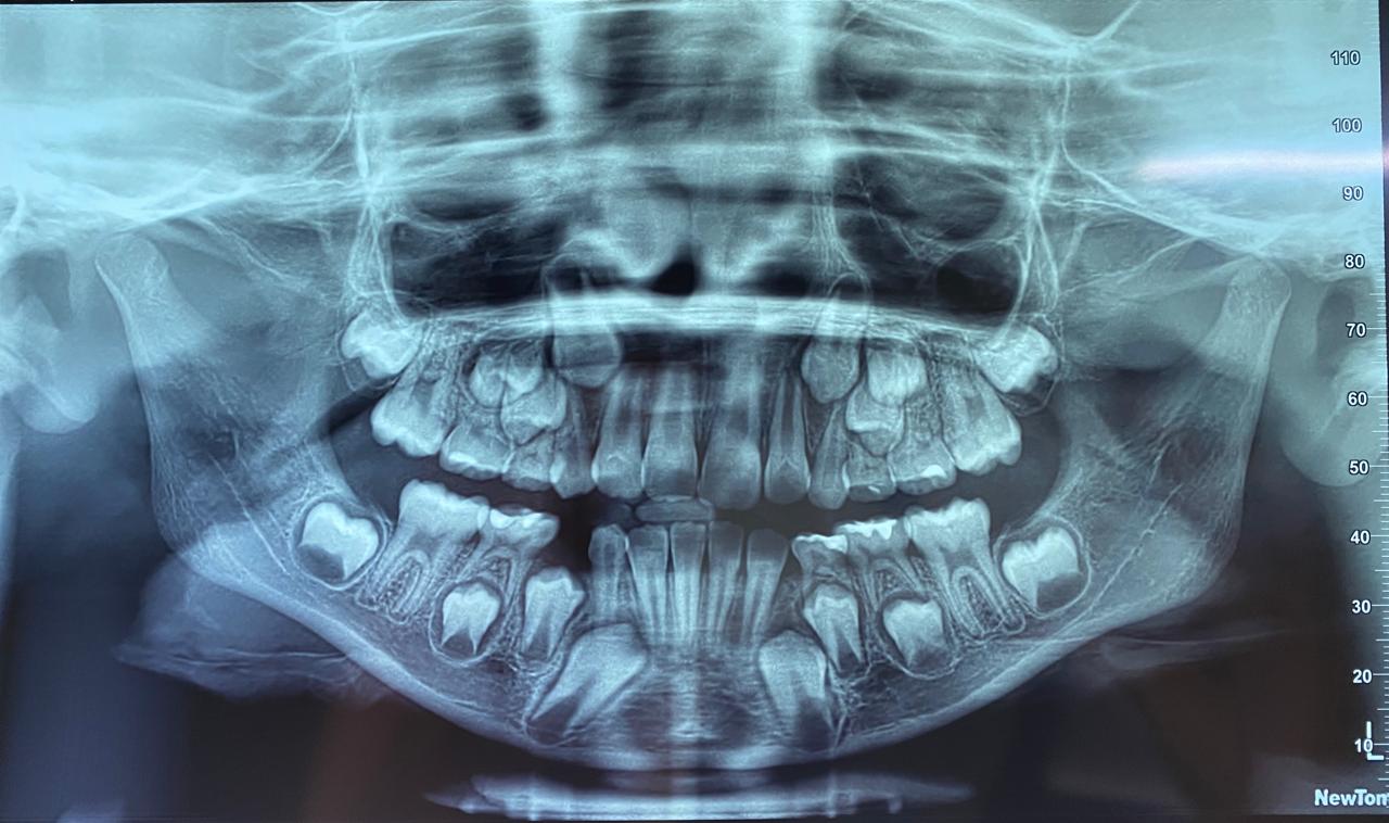 WENDLER DENTAL
