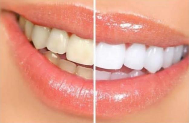 WENDLER DENTAL