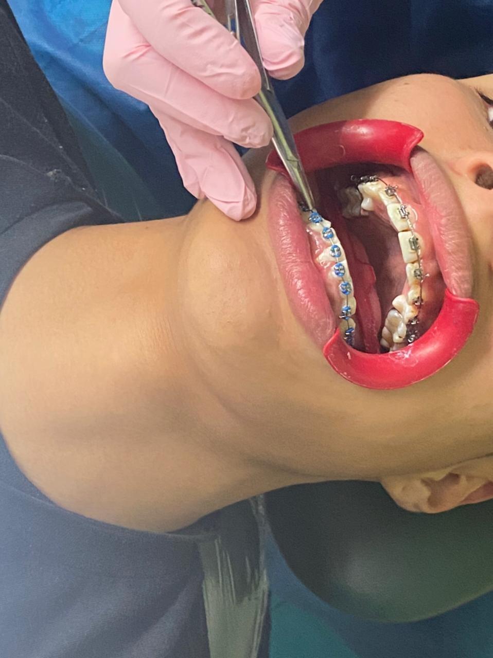 WENDLER DENTAL