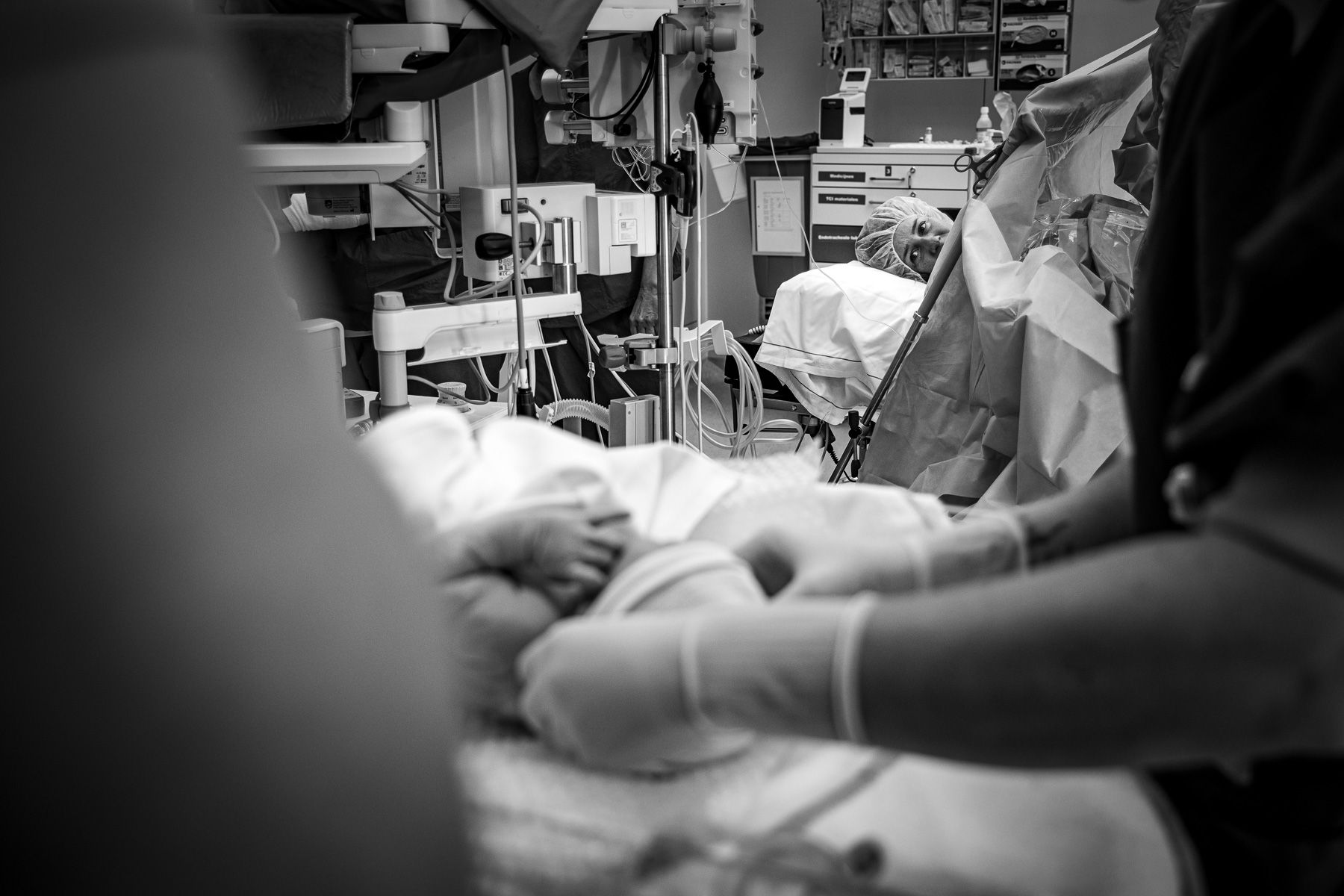 Medisch team doet controles bij baby na keizersnede uit in de operatiekamer, moeder kijkt vanaf operatietafel toe