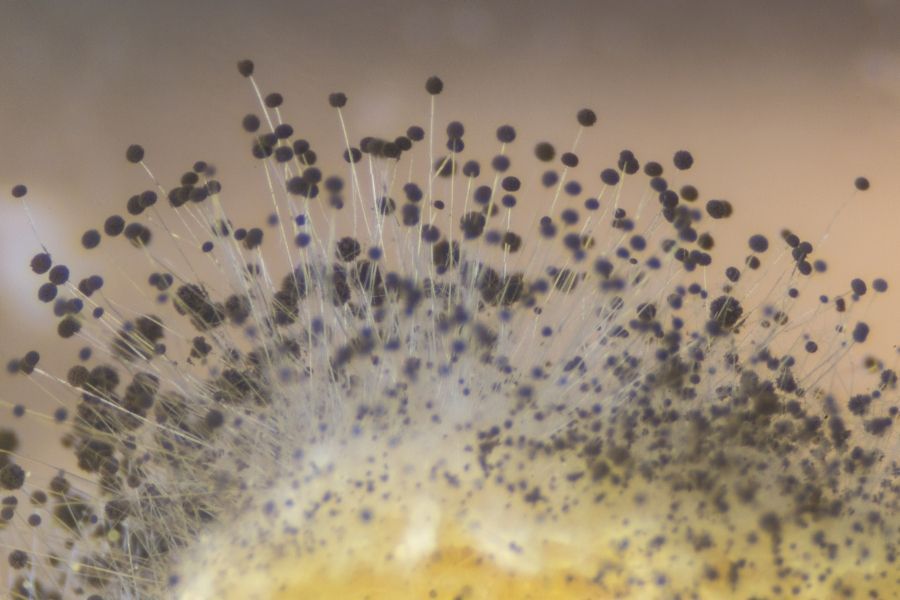 Close-up of mold spores under microscope