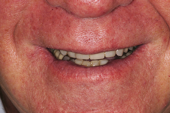 A close up of a person 's mouth with a smile on it.