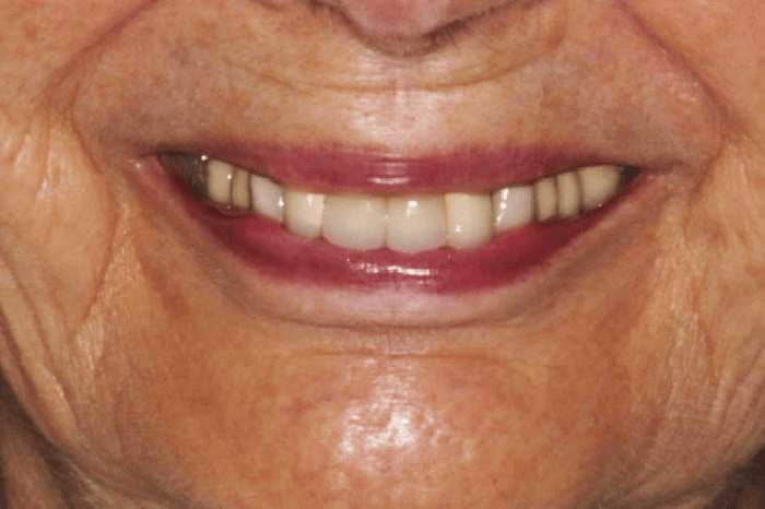 A close up of a woman 's smile with white teeth and red lips.