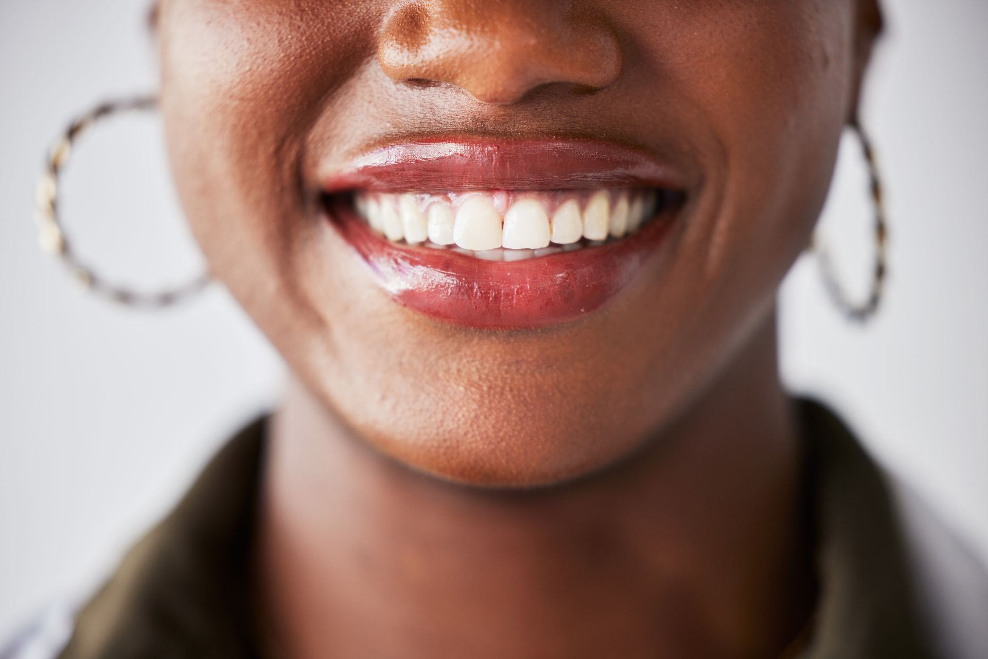 Smile, happy and mouth closeup of black woman with teeth whitening, dental care and wellness.