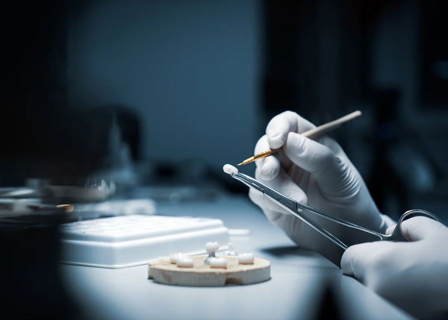 In un laboratorio clinico, delle mani guantate utilizzano degli strumenti per modellare o dipingere con cura una piccola corona dentale.