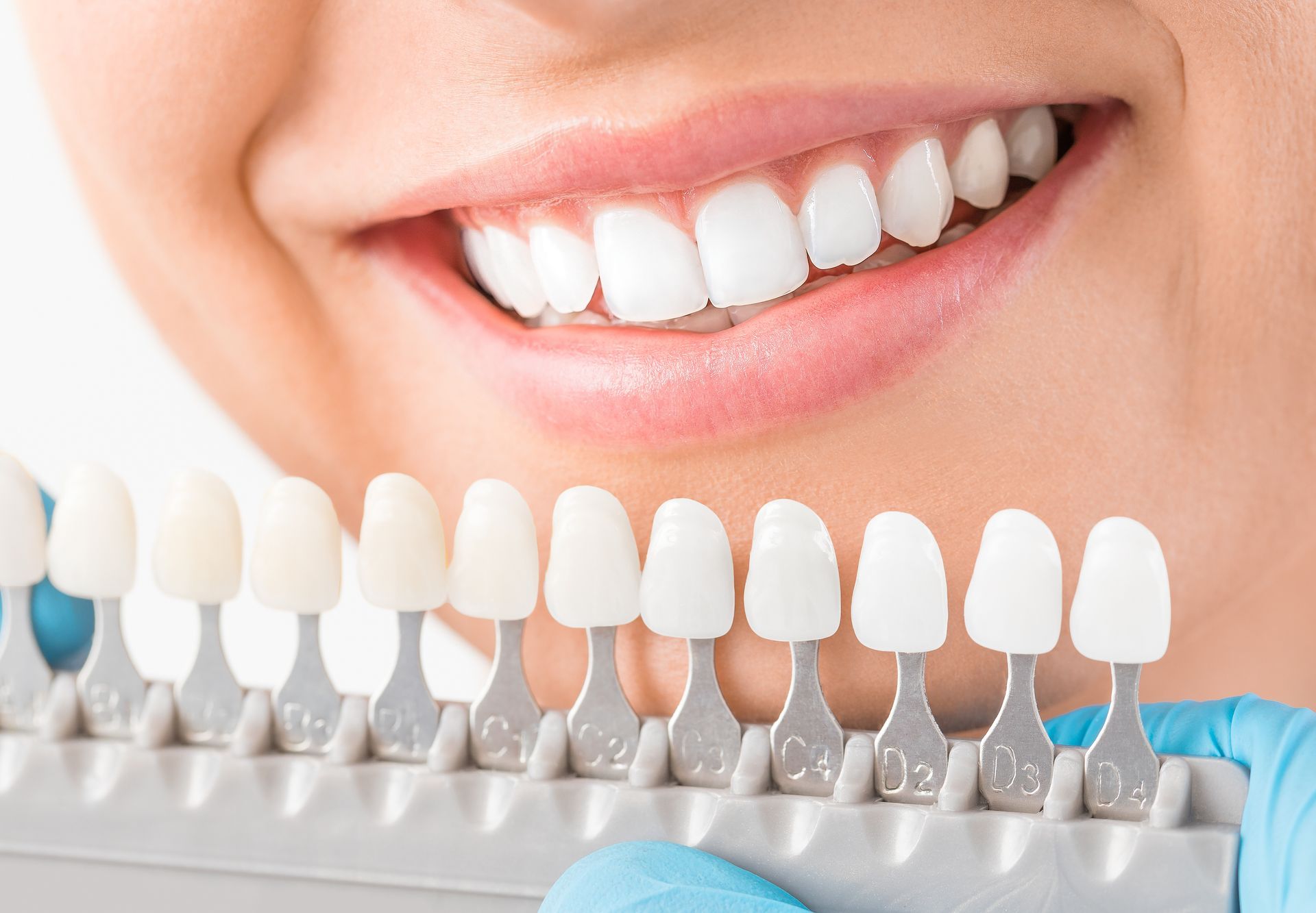 Woman smiling, holding teeth shade guide. White teeth compared to various shades for whitening.