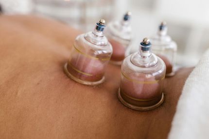 Cupping Therapy Ohio