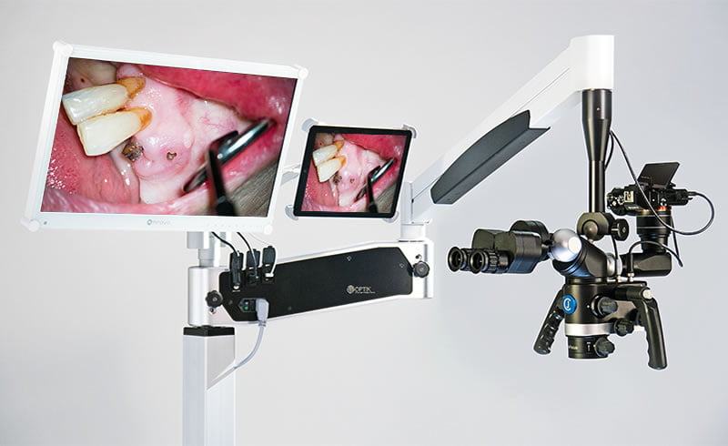 Dental surgical microscope displaying close-up views of teeth and gums with attached camera and monitor