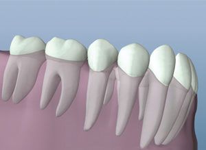 A close up of a row of teeth in a person 's mouth.