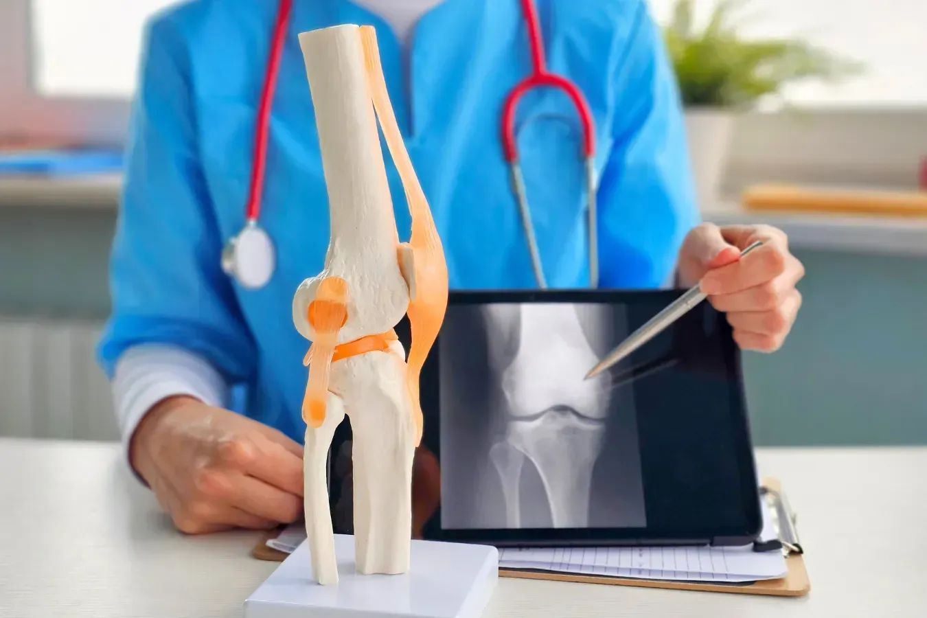 Orthopedic specialist explaining knee replacement surgery using a knee model and X-ray