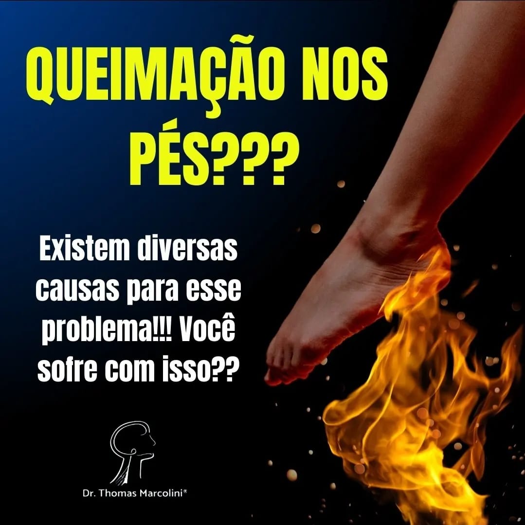 Queimação nos pés como Aliviar?