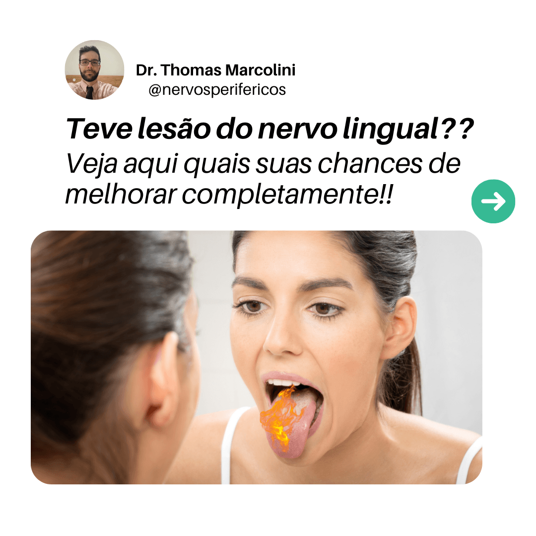 Mulher se olhando no espelho com a língua para fora, testando a sensibilidade após parestesia do nervo lingual