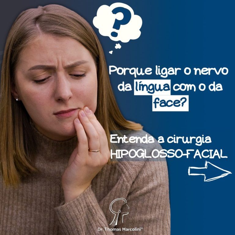 Cirurgia Hipoglosso-Facial Cirurgia Hipoglosso-Facial – Utilizando O Nervo Da Língua Para Reinervar A Face!