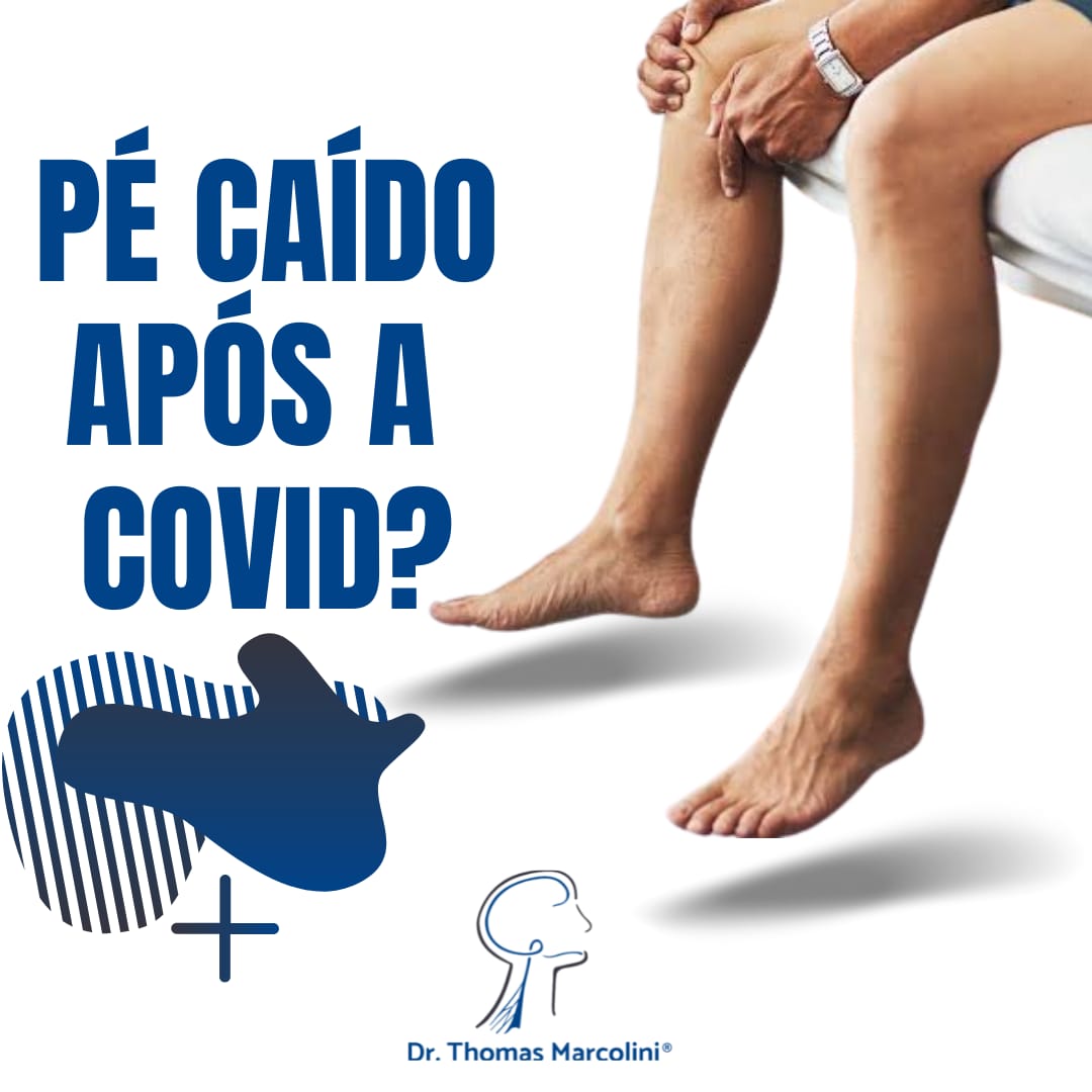 Pé Caído E Covid 19 como tratar Pé Caído E Covid 19 – Diagnóstico E Tratamento Da Neuropatia Do Nervo Fibular Em 2022.