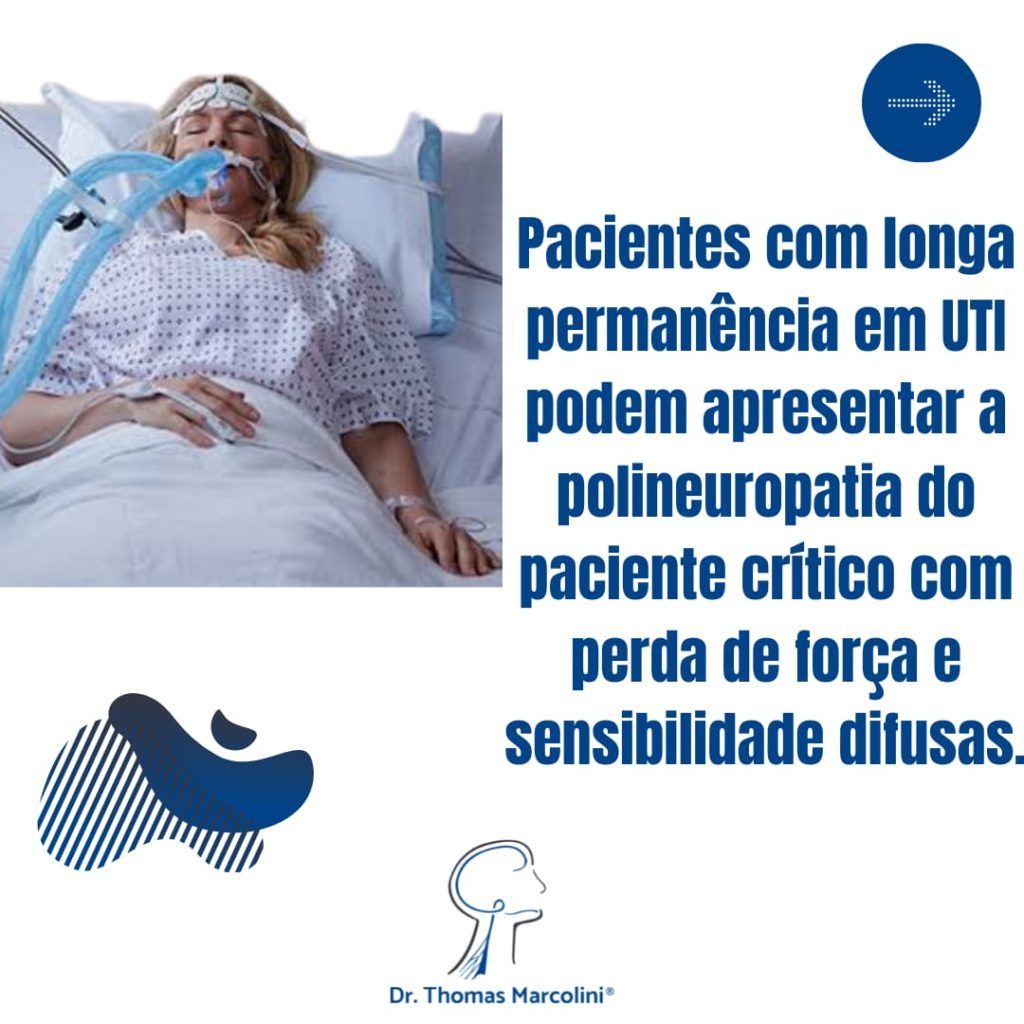 Pé caído - Polineuropatia por covid em UTI Paciente com pé caído devido ao covid