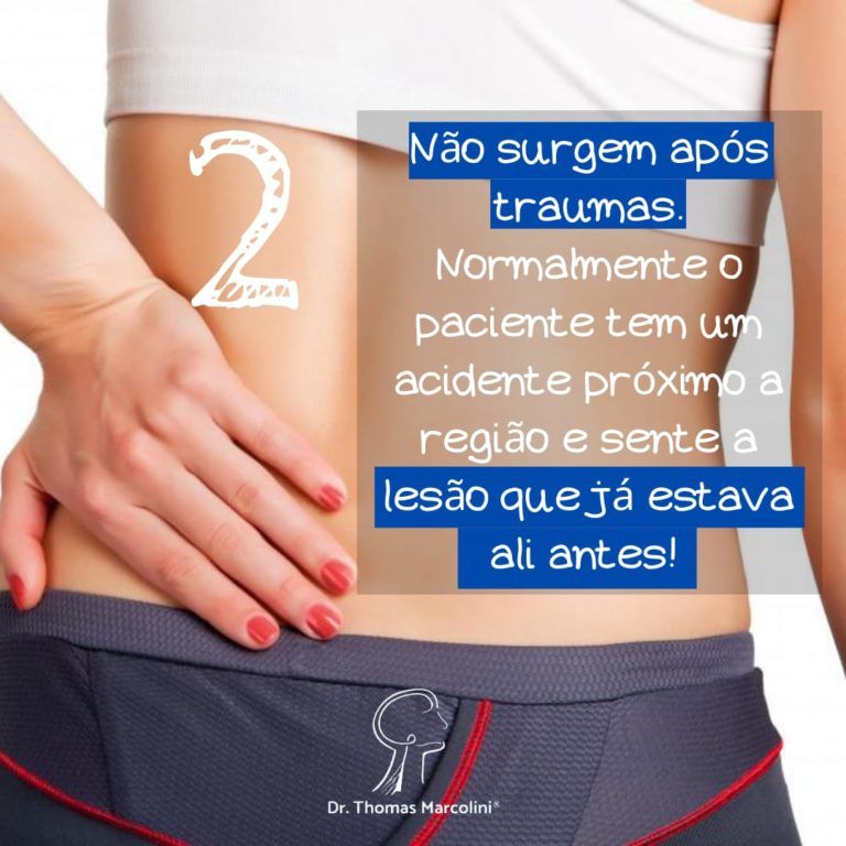 Paciente com a mão na lombar, tumor da bainha do nervo não surge após trauma