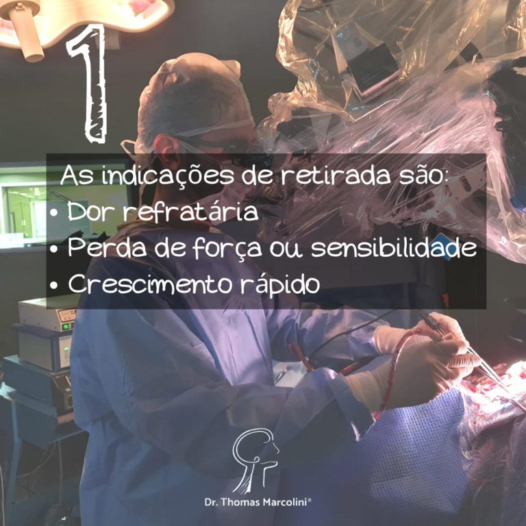 Equipe cirúrgica em procedimento, indicações de retirada de tumor da bainha do nervo periférico