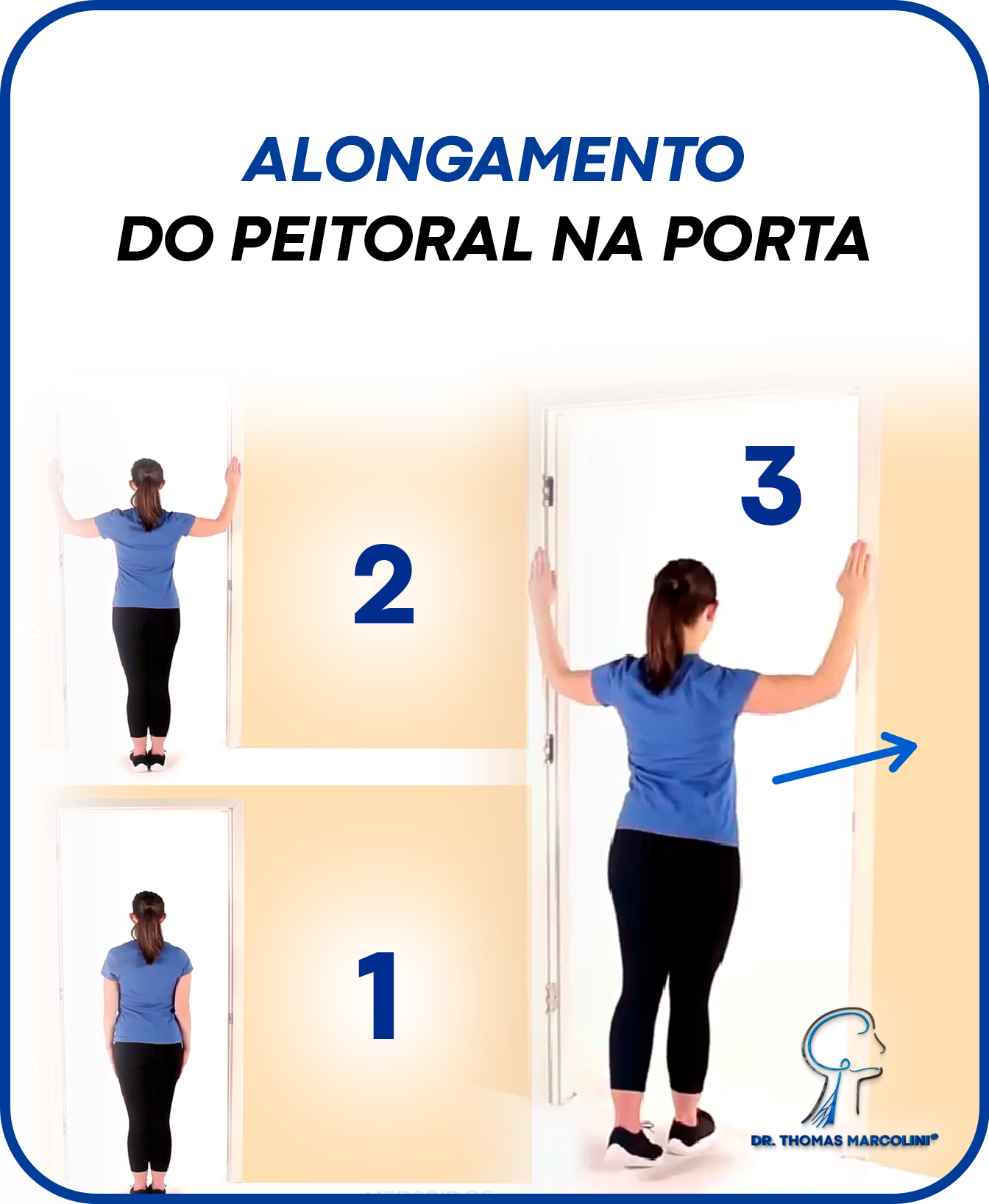 Alongando o peitoral para melhorar a síndrome do desfiladeiro torácico.