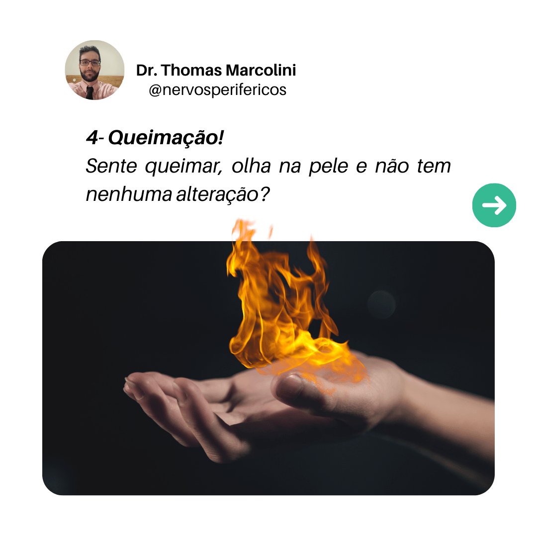 Mão com chama sobre a pele, representando a sensação de queimação sem lesão visível, sintoma de problema nos nervos periféricos