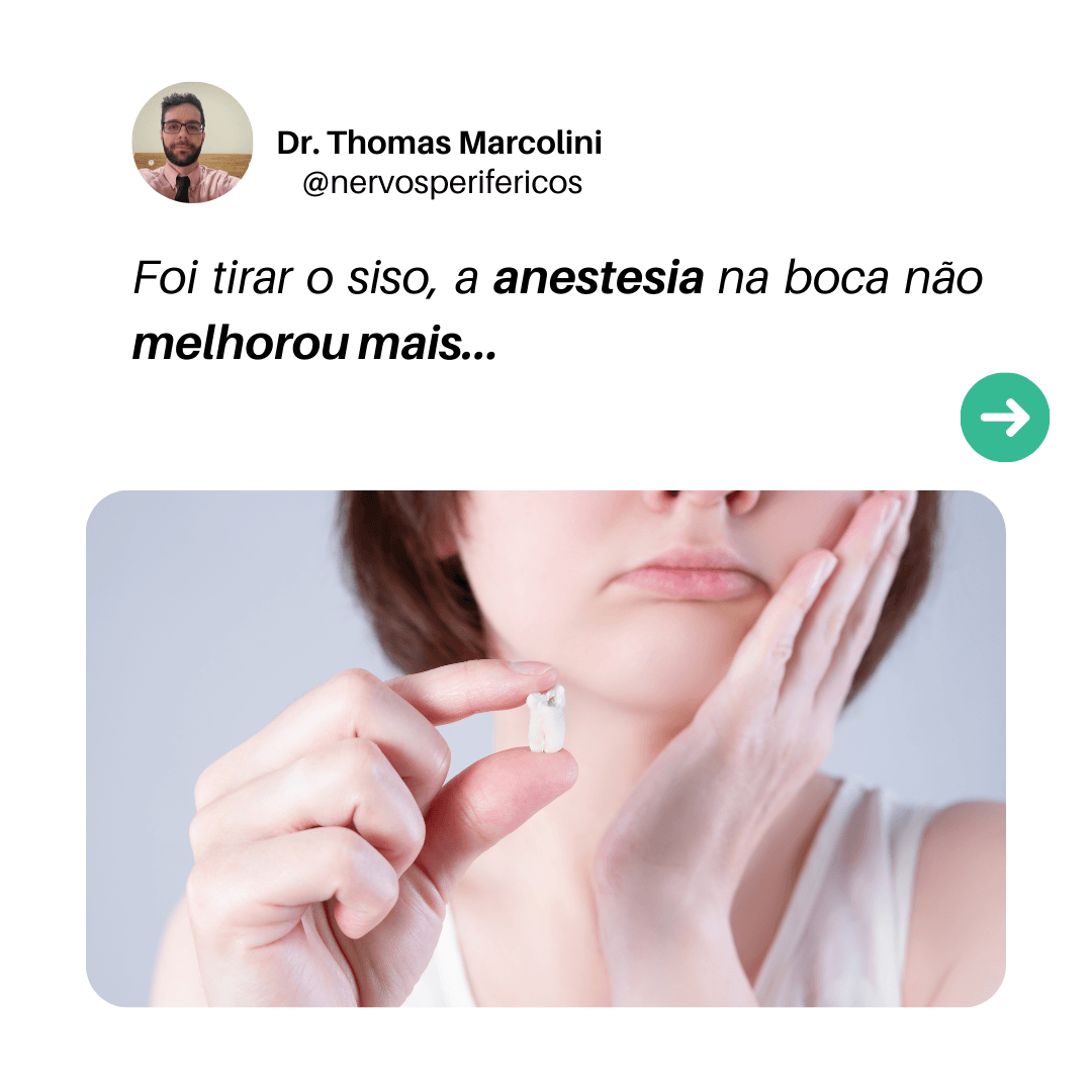 Mulher segurando o dente do siso extraído com a mão no rosto, ilustrando a dormência após lesão do nervo lingual