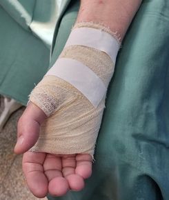 Médico para Lesões Compressivas dos nervos Médico para Lesões Compressivas de nervos periféricos