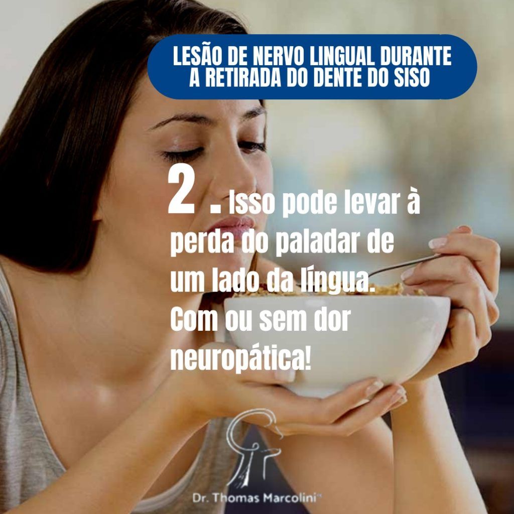 lesão do nervo da língua durante a retirada do siso