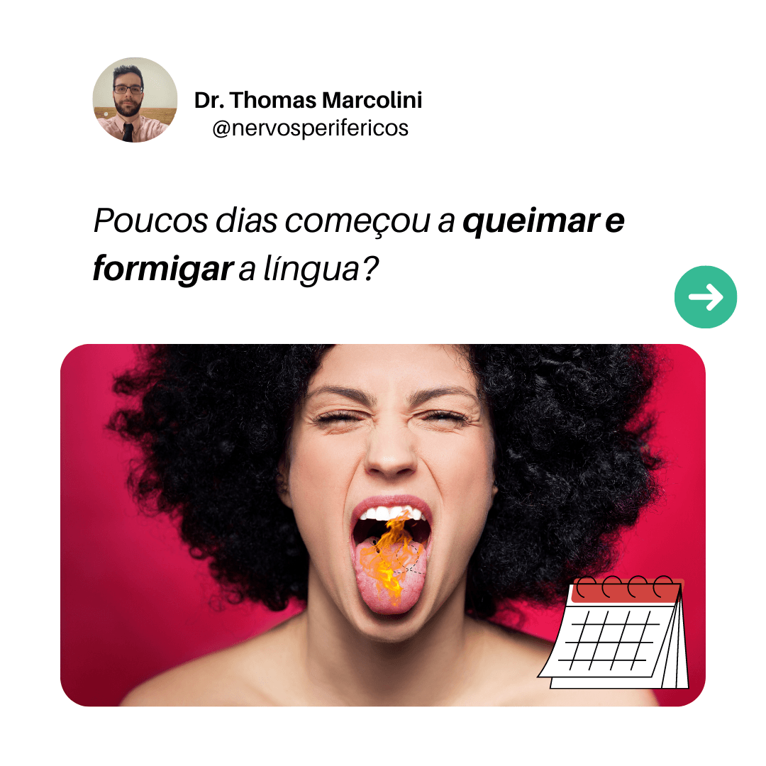 Mulher com a língua para fora e efeito de chama, representando a sensação de queimação e formigamento da parestesia lingual