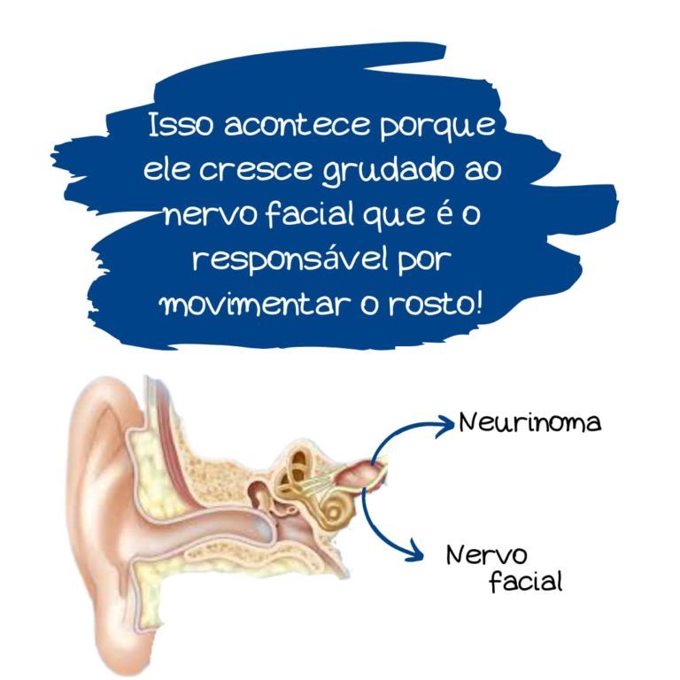 fisioterapia facial fisioterapia facial