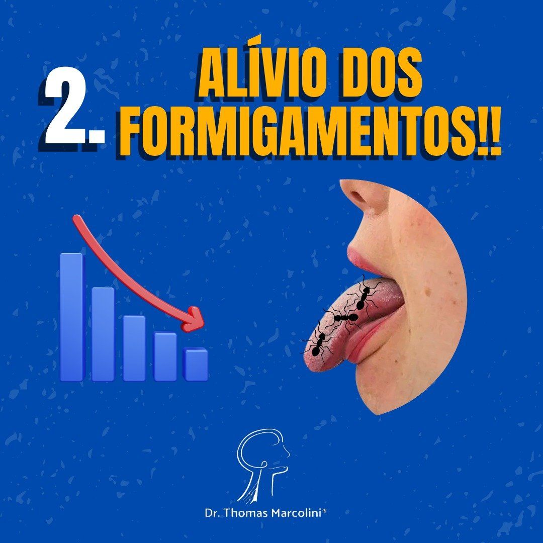 Como saber se o nervo lingual foi lesionado? Melhora do formigamento na língua após cirurgia do siso.