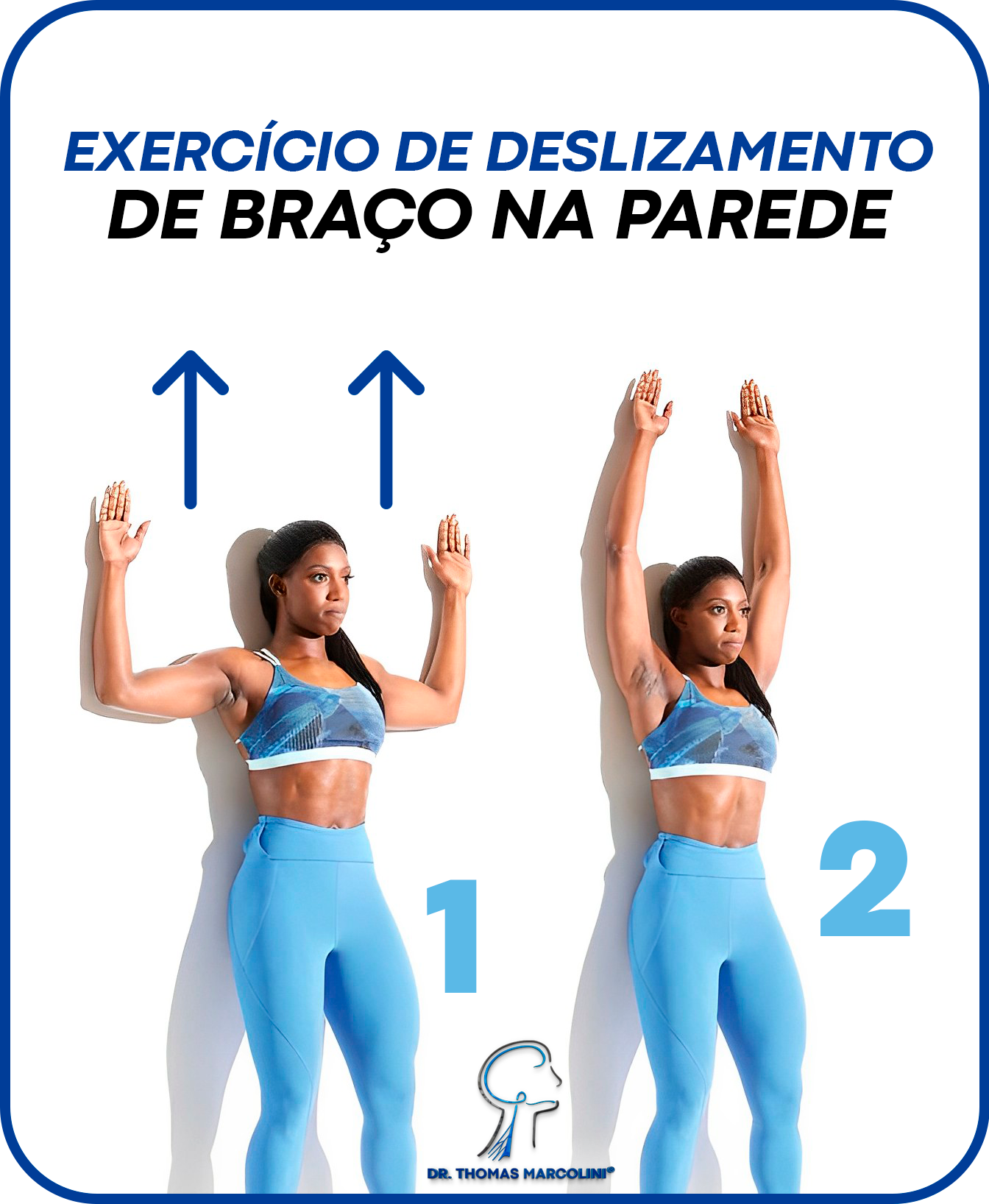 Exercícios para melhorar a síndrome do desfiladeiro torácico
