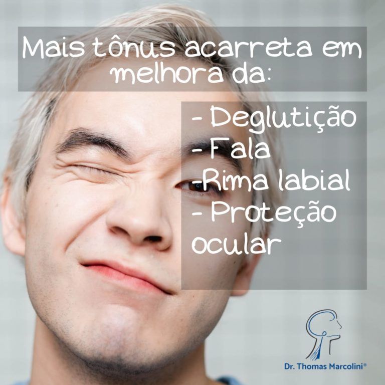 Melhora do tônus Melhora do tônus da face fisioterapia do rosto para lesão do nervo facial