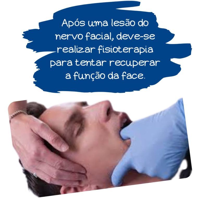 Nervo facial Nervo facial