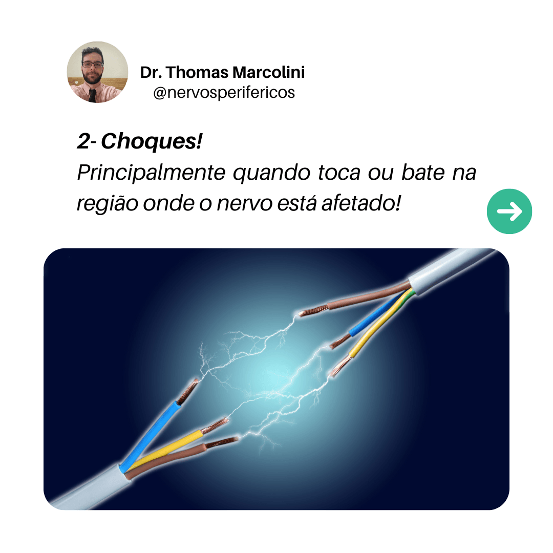 Fios elétricos desencapados soltando faíscas, ilustrando os choques na pele causados por lesão nos nervos periféricos