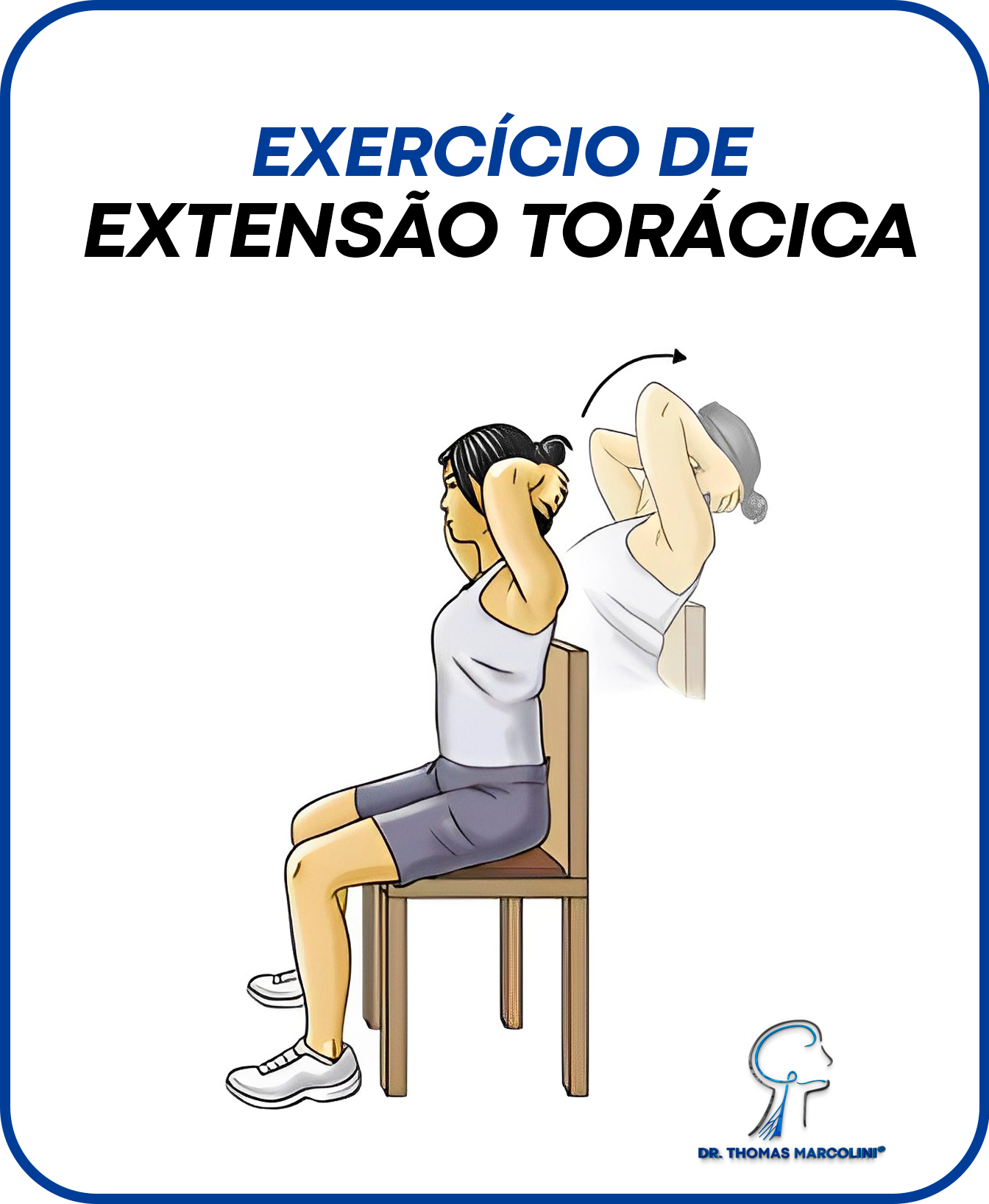 Exercício de extensão torácica para melhora da síndrome do desfiladeiro torácico