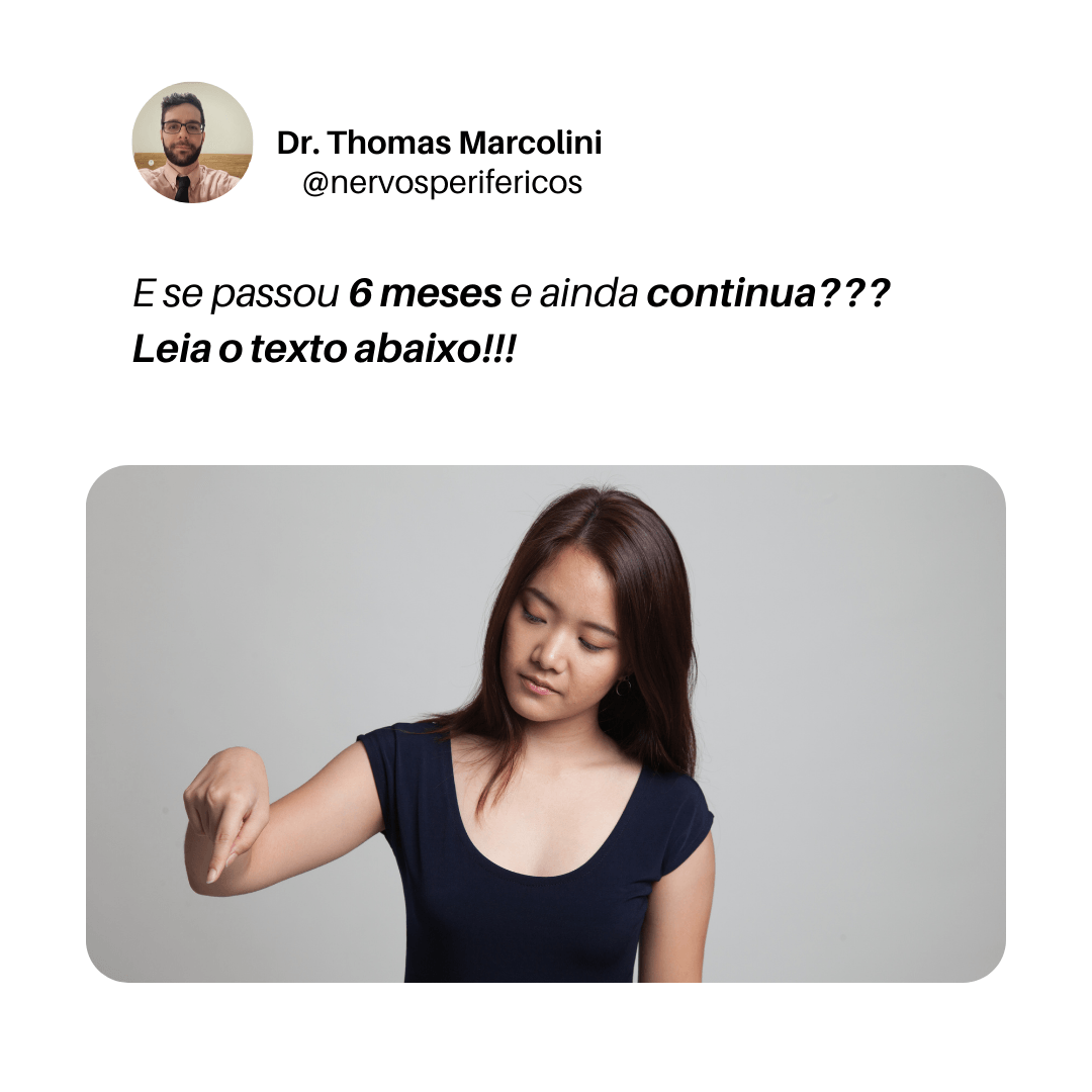 Mulher apontando para baixo com o dedo, indicando para continuar a leitura sobre a parestesia do nervo lingual