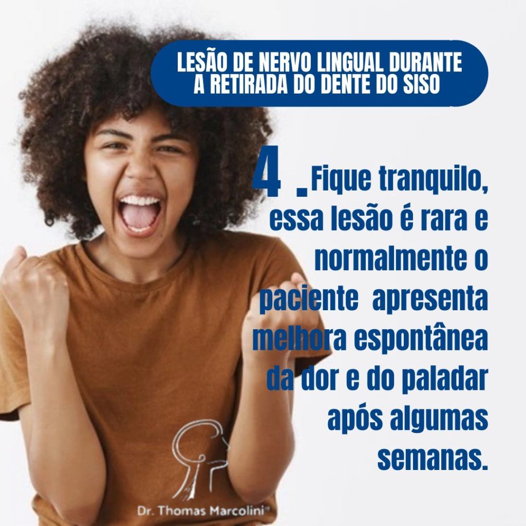 Neuropraxia do nervo lingual