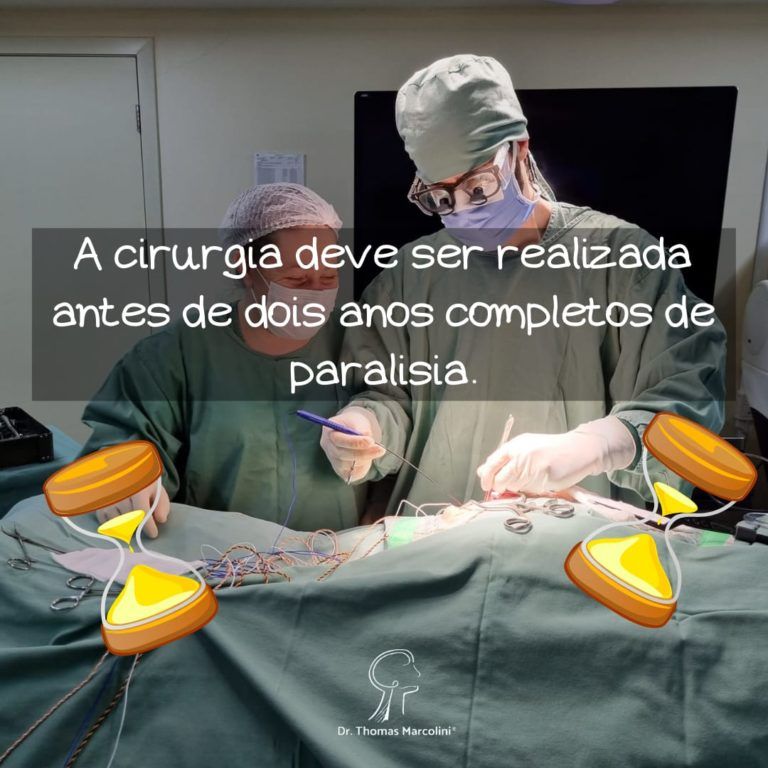 Quanto tempo depois da paralisia facial posso fazer cirurgia? Quanto tempo depois da paralisia facial posso fazer cirurgia?