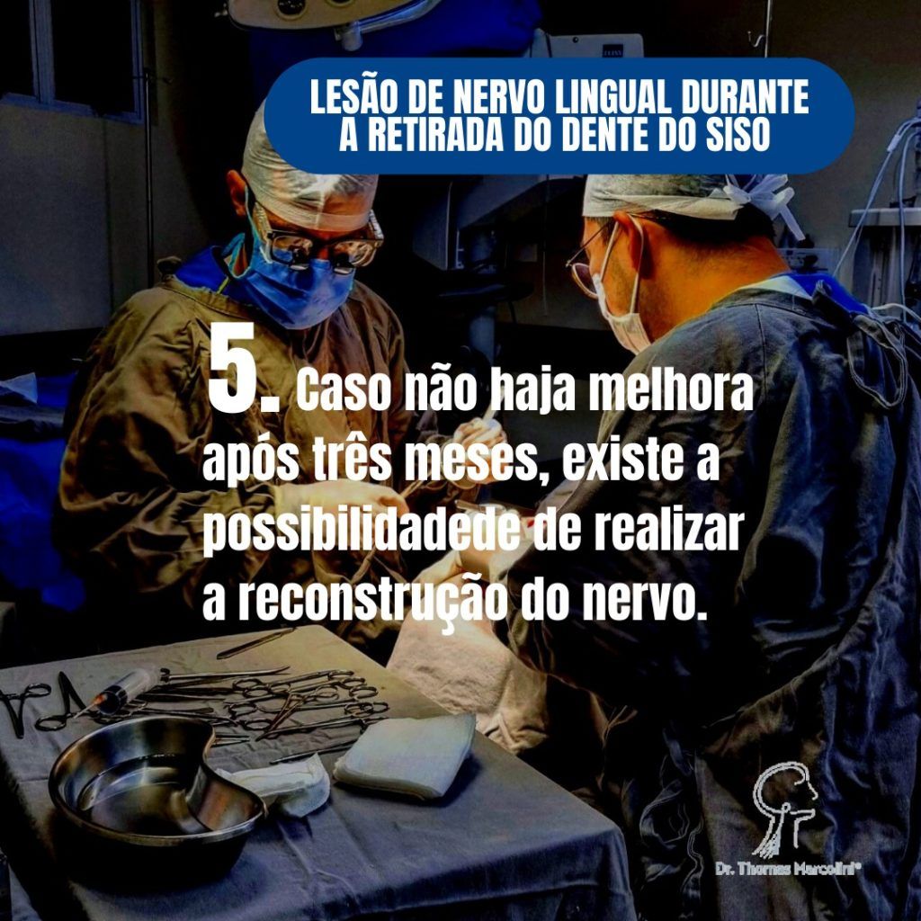 Cirurgia para reconstrução do nervo lingual